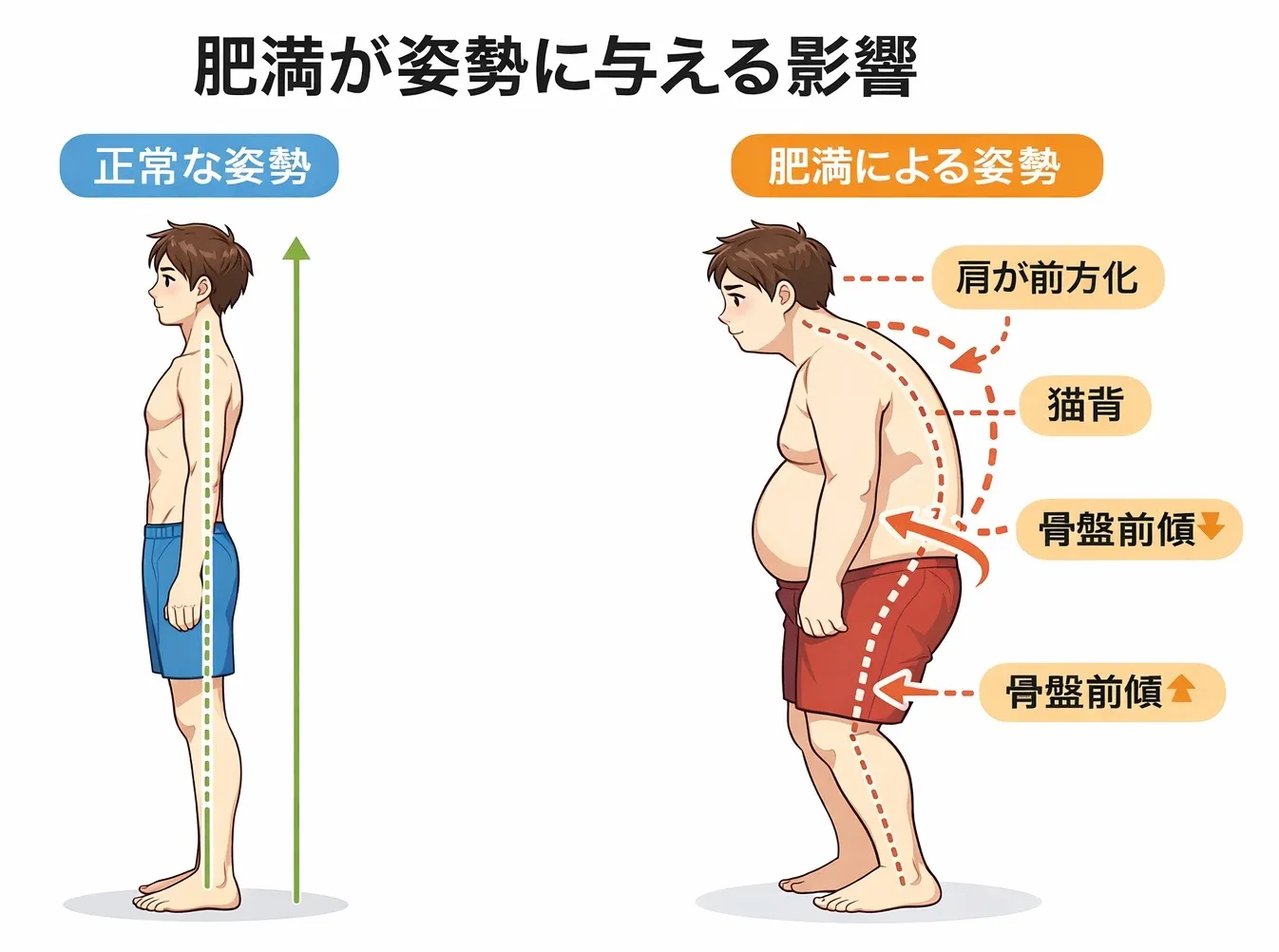 肥満と姿勢の関係