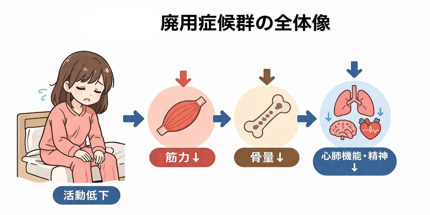 廃用症候群とは?