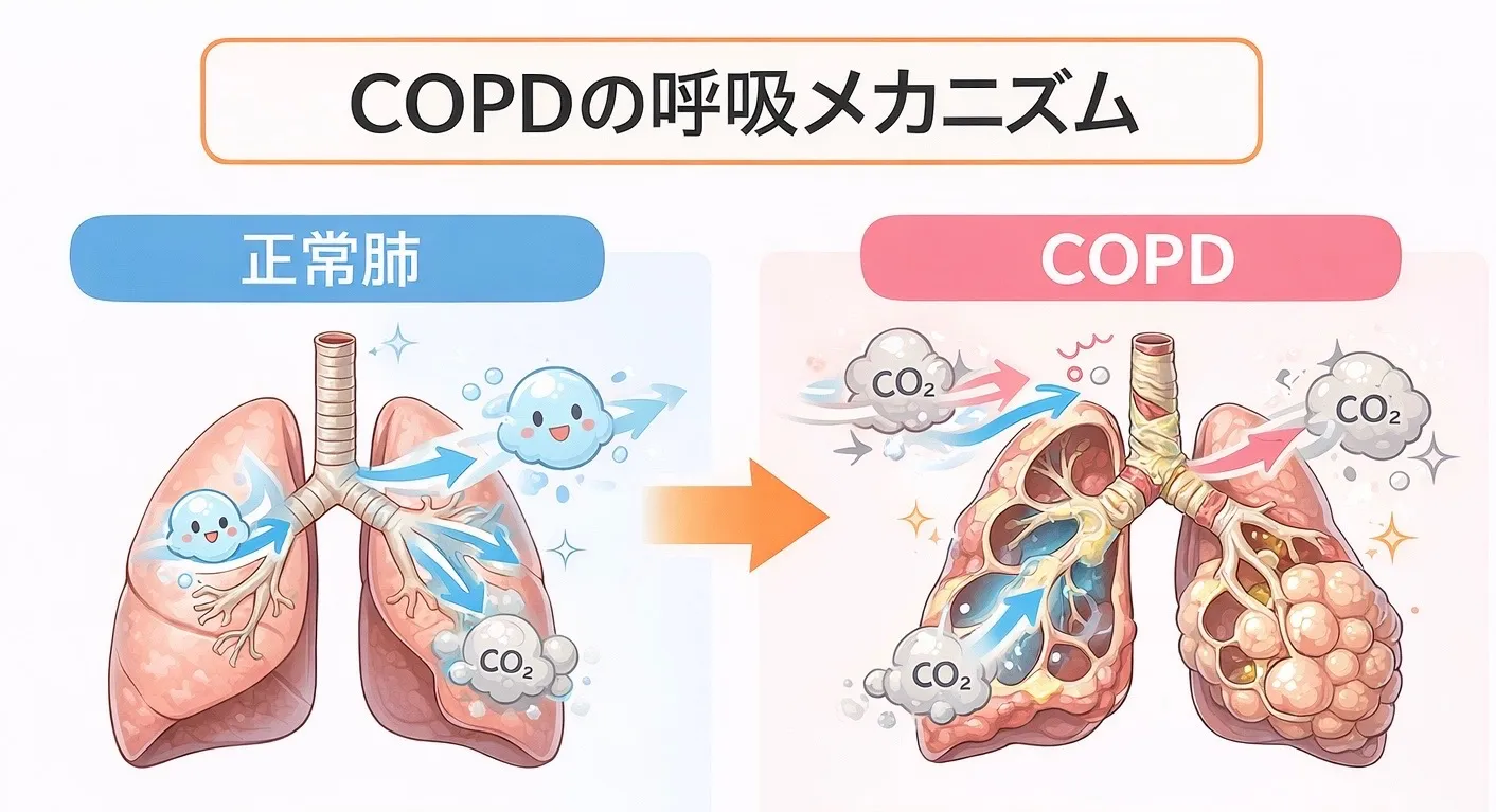 COPDに対する運動療法の効果