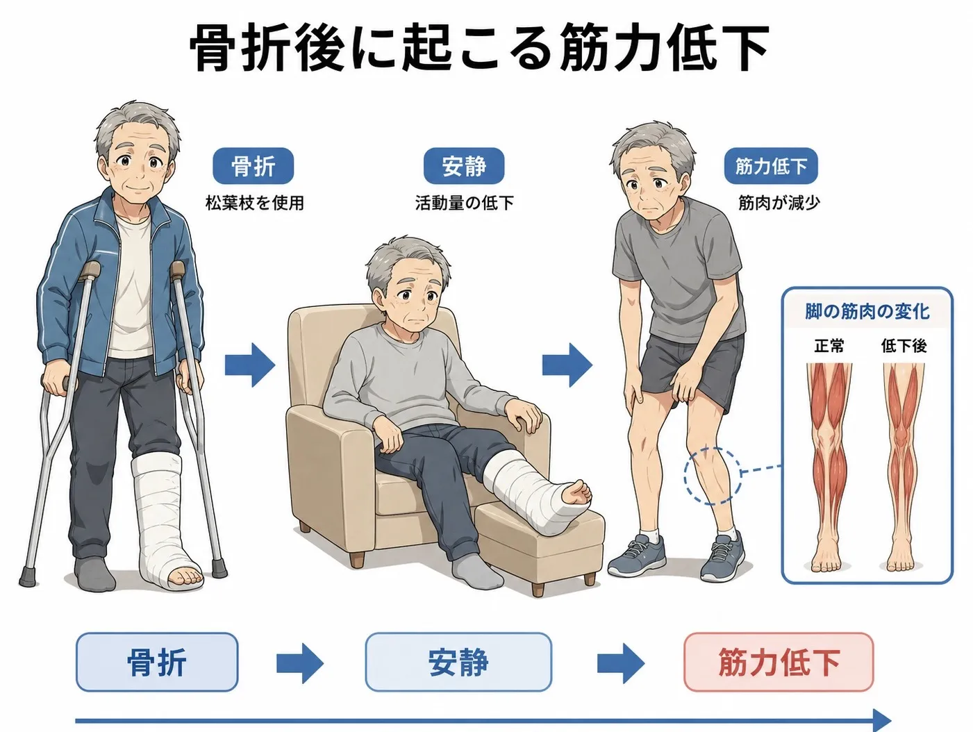 骨折による筋力低下及び寝たきりのリスク